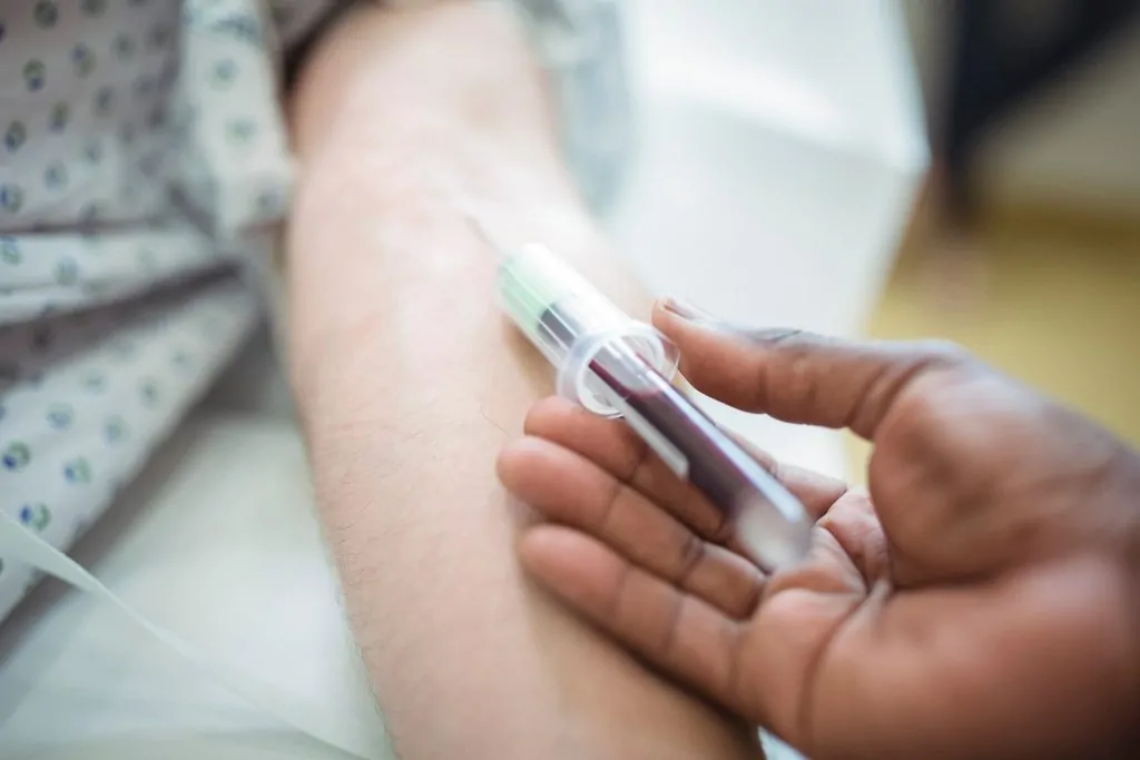 doctor collecting blood sample for tuberculosis test